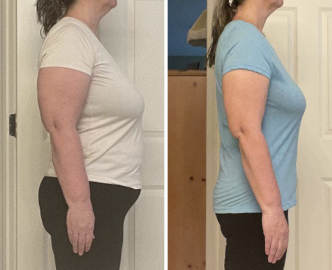 Neora before and after result